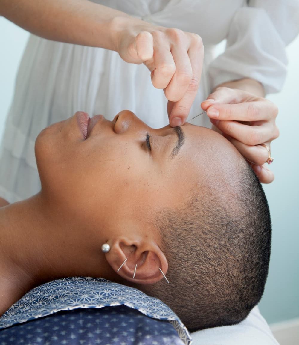 Acupuncture Liability Insurance Options For Individuals or